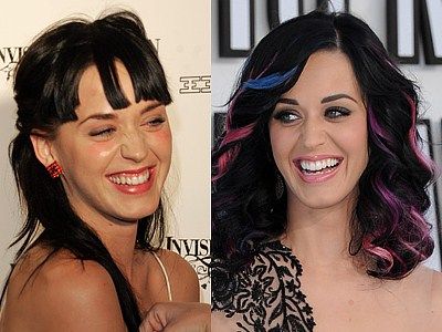 Katy Perry before dental work